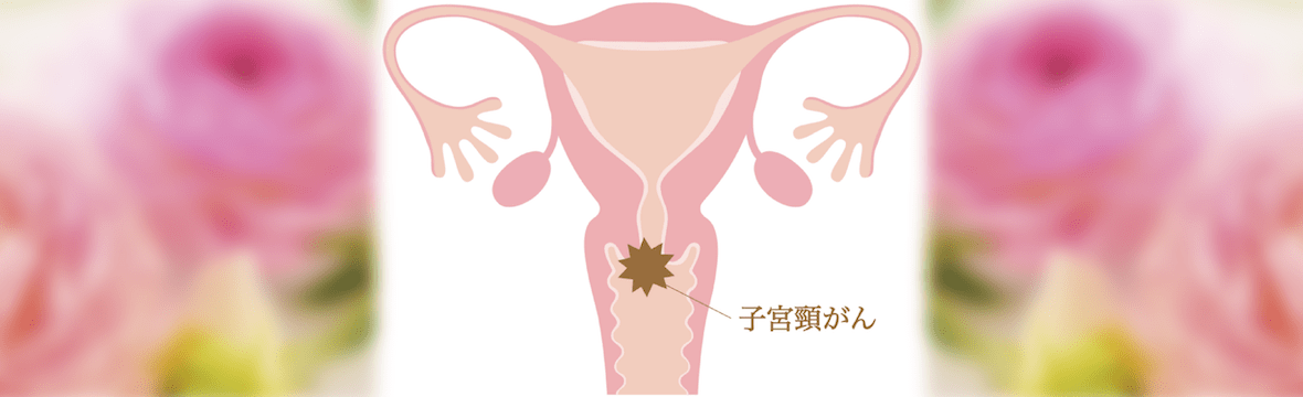 ティアラウィメンズクリニック子宮頸がん検診